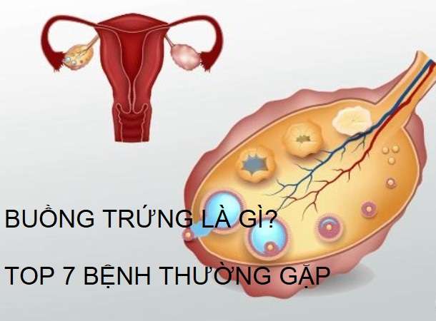 buồng trứng là gì và các bệnh thường gặp