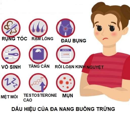 dấu hiệu đa nang buồng chứng