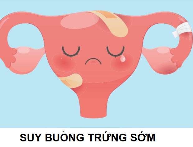 suy buồng trứng sớm là gì