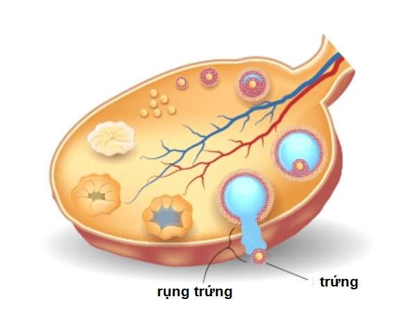 rối loạn phóng noãn